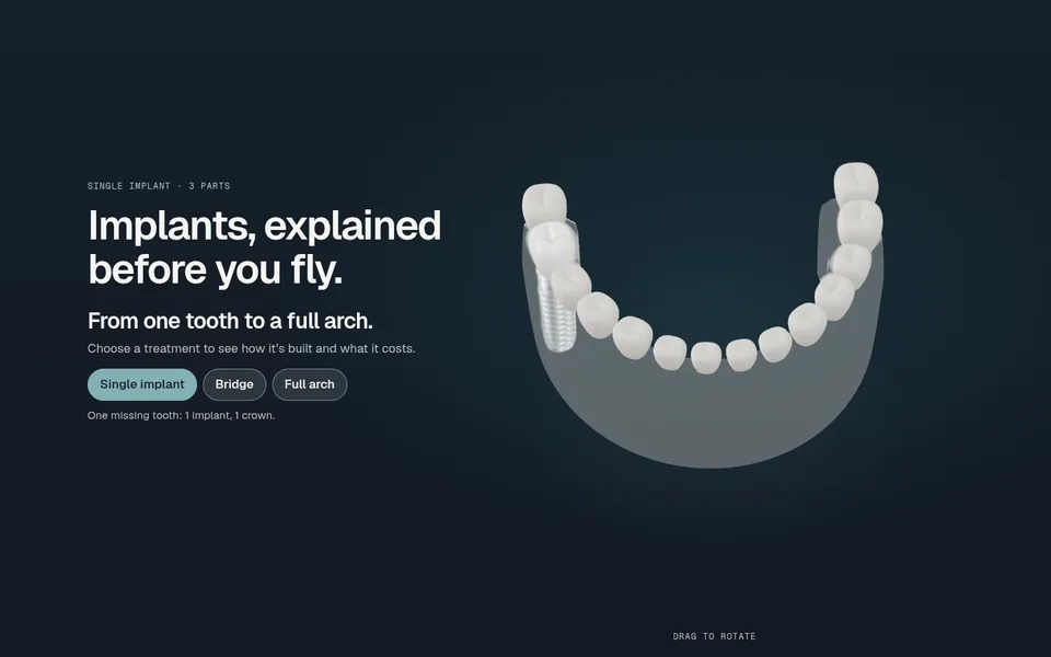 The camera pulled back to a full lower arch in frosted glass, with the single implant as the first molar and the Single implant chip selected.