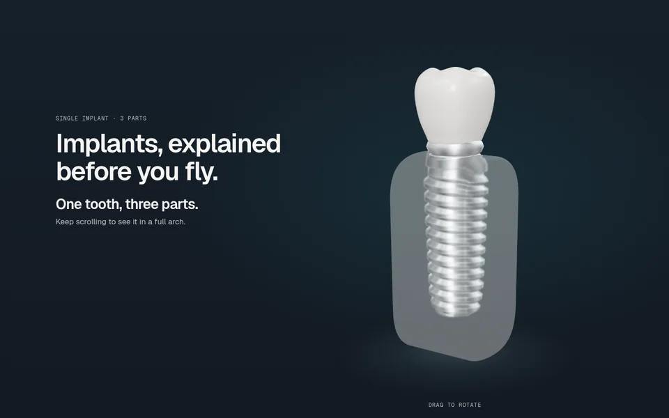 The finished implant: zirconia crown, abutment and threaded titanium post seated in the glass jaw.