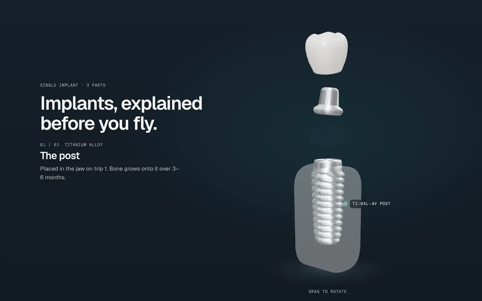 The titanium post screwing into a frosted-glass jaw section while the abutment and crown wait above.