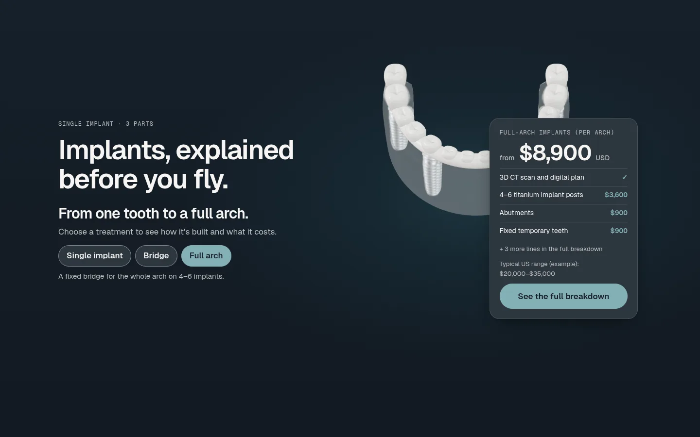The full-arch model steps back behind an itemised price card: full-arch implants from $8,900 USD, with implant posts, abutments and temporary teeth priced line by line.