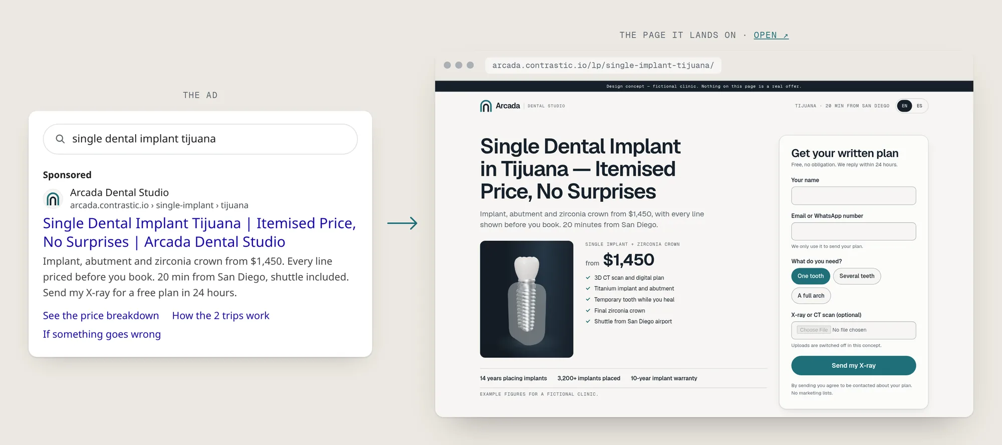 A Google search ad for a single dental implant in Tijuana beside its landing page, which mirrors the headline and adds a 3D implant still, a $1,450 price and a form.